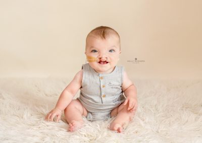 baby with cleft lip during a photoshoot in Kent